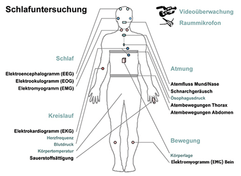 Abbildung Kardiorespiratorische Polysomnographie